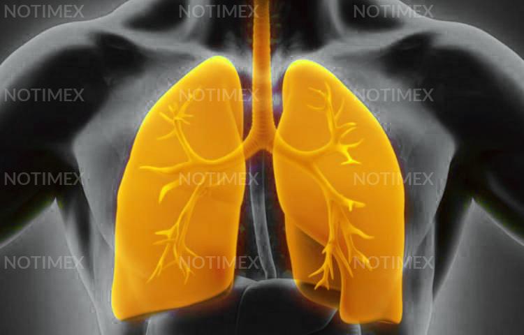 Deficiencia de AAT ocasiona enfermedades pulmonares